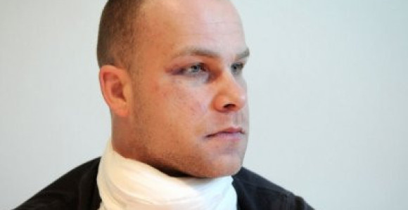 Бањалучанин тврди да су га претукли специјалци