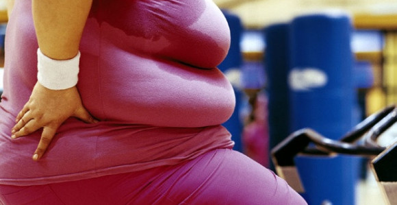 Ekstremna gojaznost skraćuje život