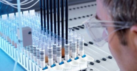 HEPATITIS - Tihi ubica