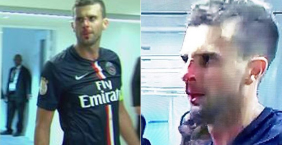 PSŽ: Doživotna kazna za Brandaa!!!