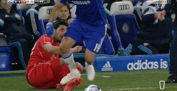 Коста не игра против Ситија због ''гажења''?!