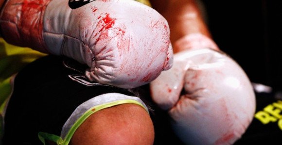 Tragedija UKIDA boks u Australiji?!