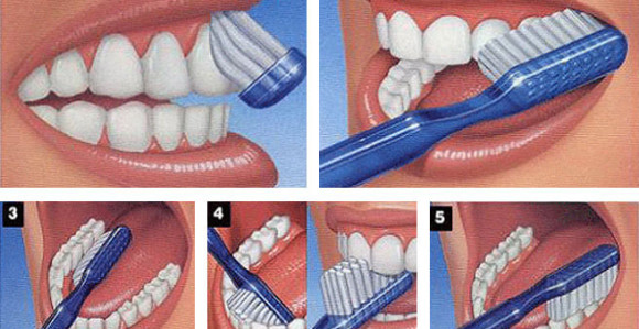 Zubi stradaju zbog pogrešnog pranja
