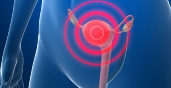 Miomi se "tope" i bez operacije