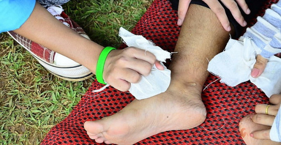 Sportske povrede mogu da se izbjegnu