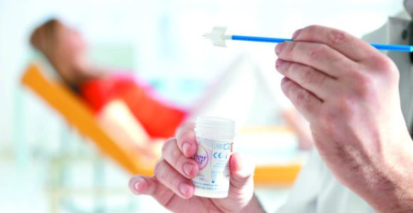 HPV skrining zamijenio Papa test