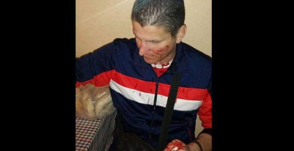 Navijači Zvezde izbodeni nakon meča sa MZT u Skoplju!