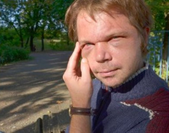 Privedeni maloljetnici koji su pretukli nastavnika