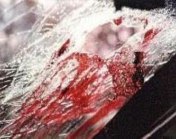 Teška nesreća kod Šapca: Poginuo mladić