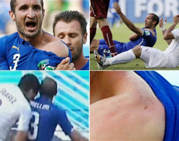 Suaresu treba terapija!