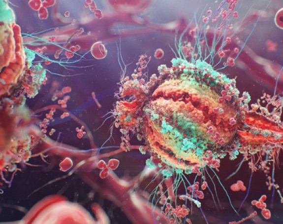 HIV virus eliminisan iz organizma