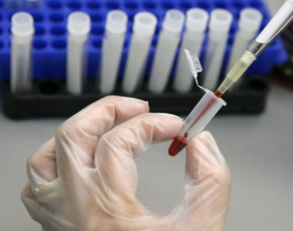 Od sutra besplatno i anonimno testiranje na HIV