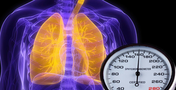 Plućna hipertenzija ugrožava mlade