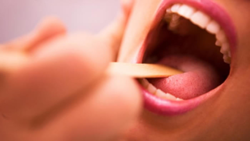 Angina se liječi antibioticima