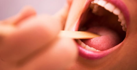 Angina  se liječi antibioticima