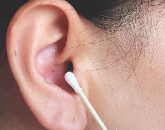 Zašto ne treba da koristite štapiće za čišćenje ušiju