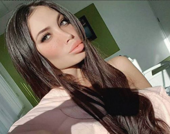 Soraja smanjila grudi i usne