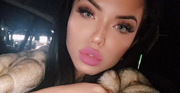 Misica stradala u ratu klanova?