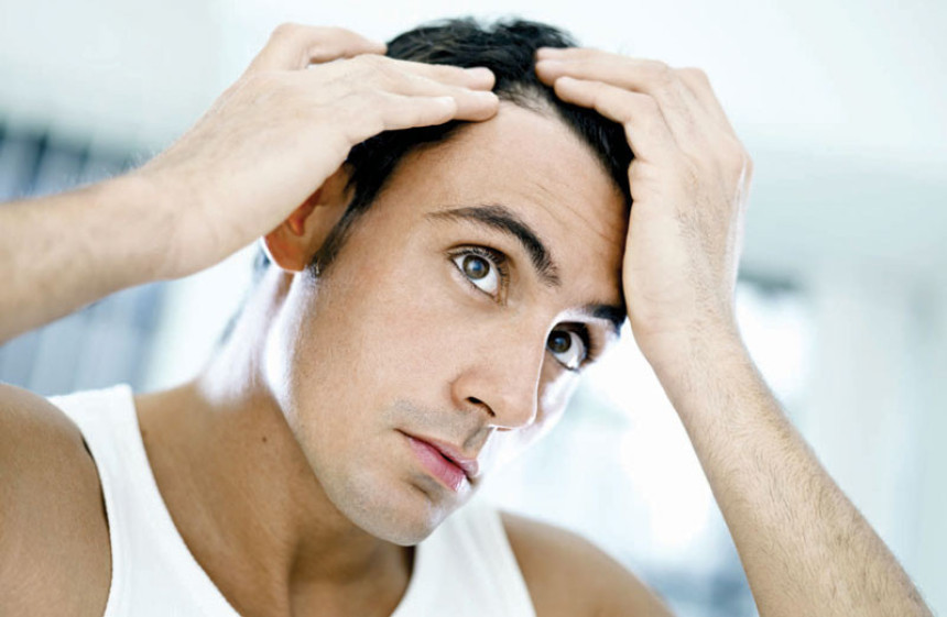 Kako usporiti opadanje kose?