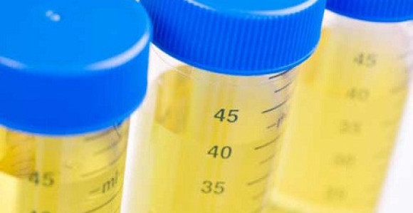 Šta se dešava kada trpite i ne idete u toalet?