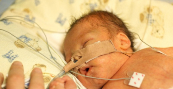 A šta kaže majka o respiratorima UKC BL?