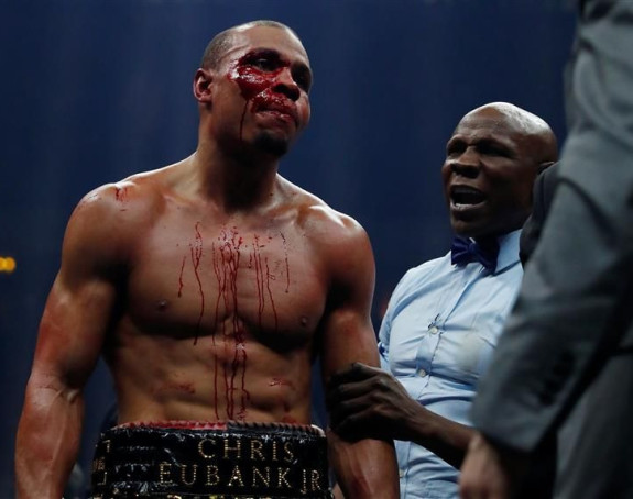 Video: Ime da, ali ne i znanje - Jubenkov sin dobio ozbiljne batine!