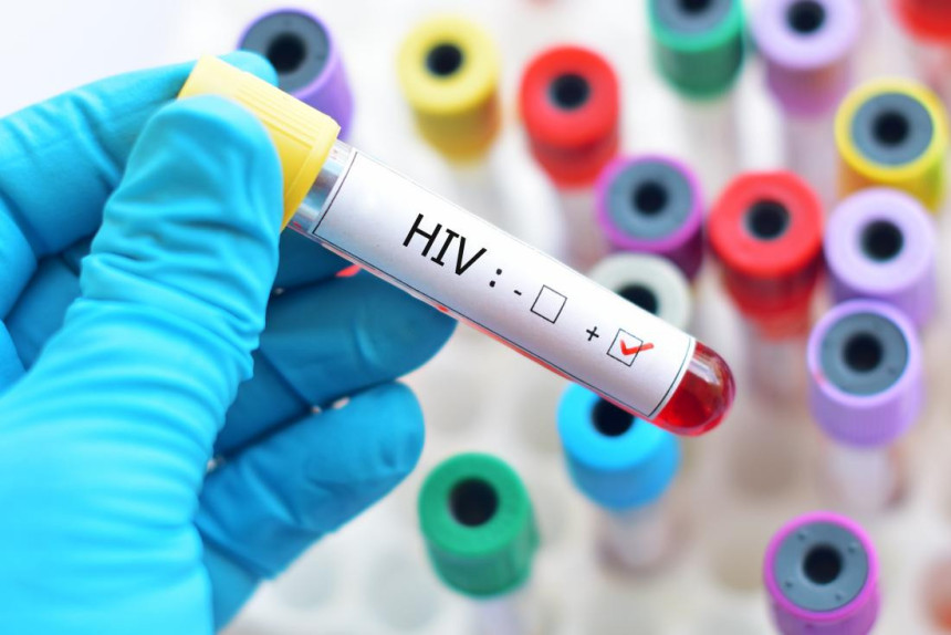 Kineski naučnici blizu pronalaska lijeka za HIV