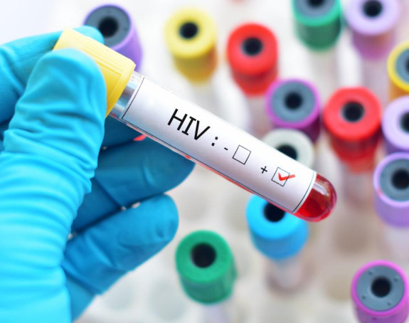 Kineski naučnici blizu pronalaska lijeka za HIV