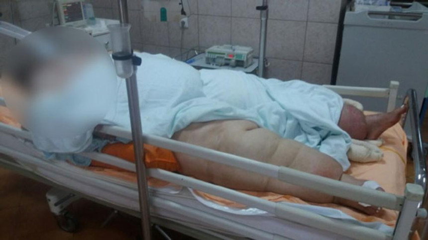 Život o koncu žene od 300 kg 