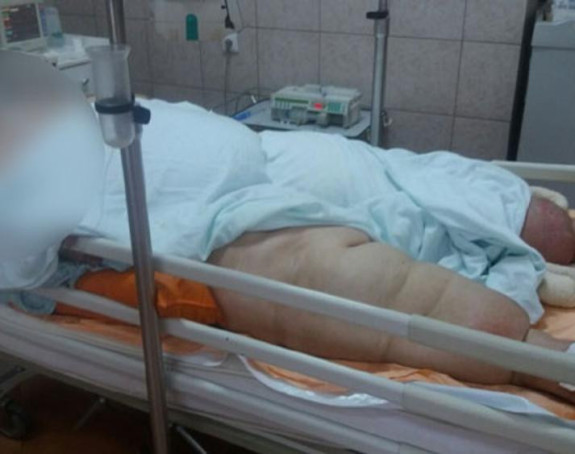 Život o koncu žene od 300 kg 