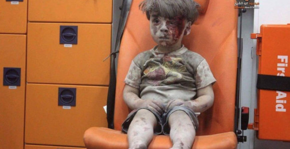 Dječje lice u krvi – slika i prilika Sirije