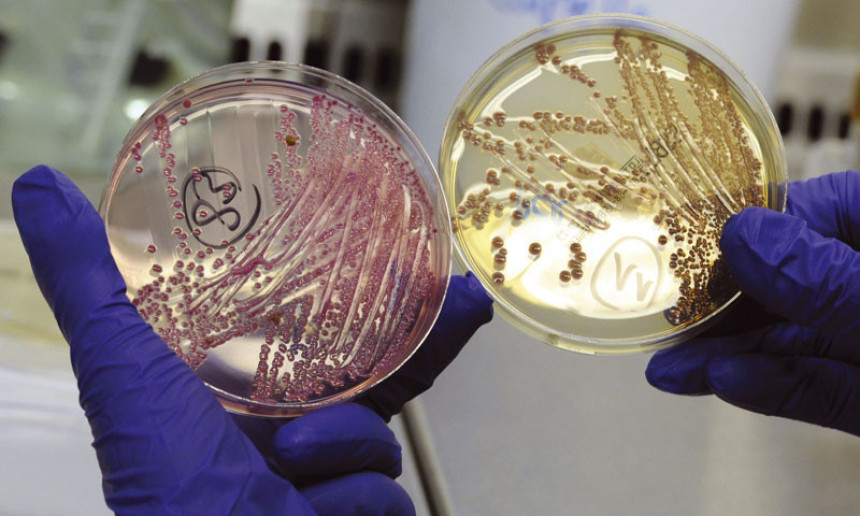 25.000 ljudi umre od rezistentnih bakterija