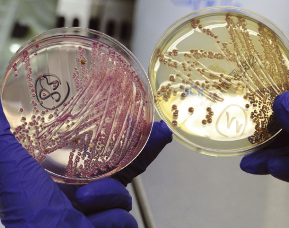 25.000 ljudi umre od rezistentnih bakterija