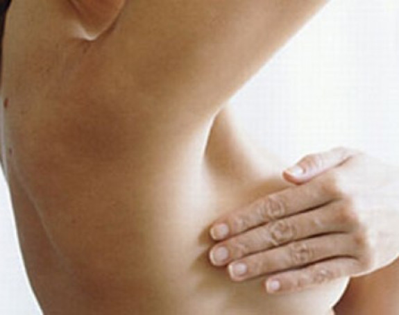 Novi lijek za rak dojke preskup za BiH