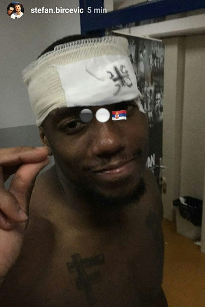 Robinson, tri prsta i "ocila" na zavoju!