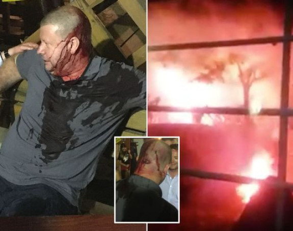 Video: Mostarci bakljama na Škote, jedan u bolnici!