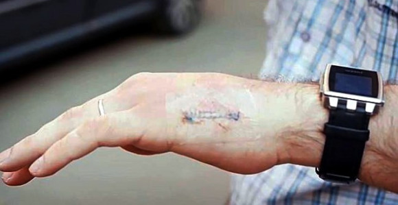 Čipovanje - možda ne vjerujete, ali se dešava