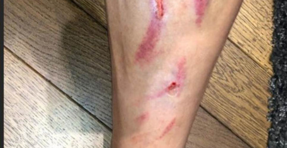 Ben "pocijepao" nogu Degeneku!