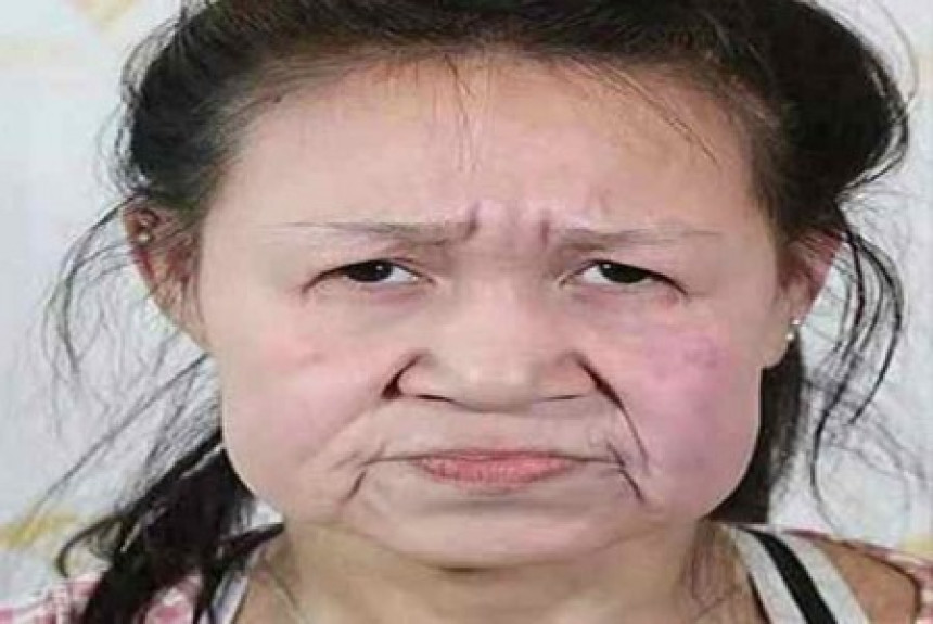 Sa 15 godina imala je lice starice a sada kao prava tinejdžerka!