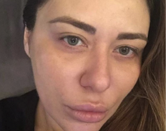 Ana Nikolić kolabirala-hitno prevezena u bolnicu!