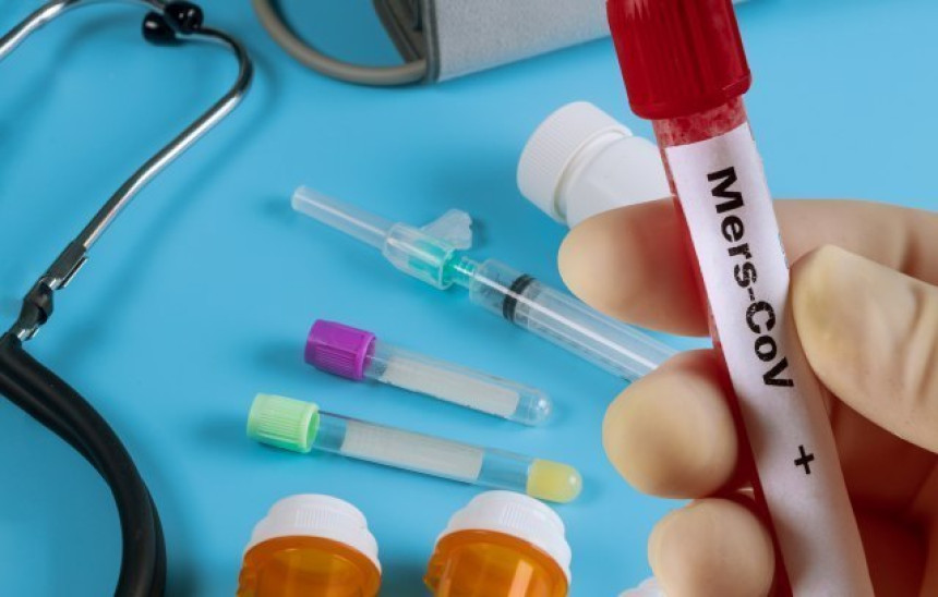 Prvi smrtni slučaj zbog koronavirusa van Kine