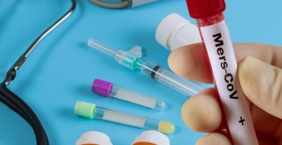 Prvi smrtni slučaj zbog koronavirusa van Kine