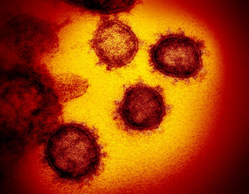 Epidemija virusa korona može preći u pandemiju?