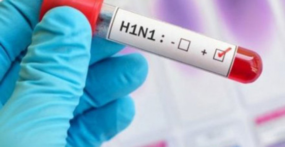 Državljanka Srbije preminula od virusa H1N1 u Bahreinu