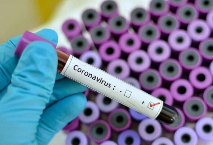 Još dvoje novih oboljelih od virusa korona u Zenici