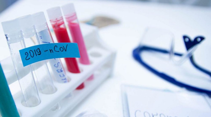 U Srbiji sedam novih slučajeva, dosad zaraženo 12 ljudi