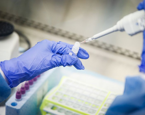 Još jedan slučaj zaraze virusom korona u Srbiji