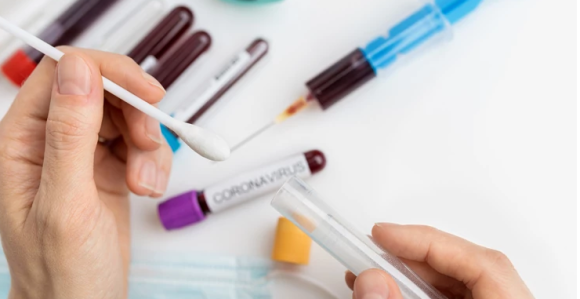 Srbija: Raste broj zaraženih virusom korona, ukupno 31