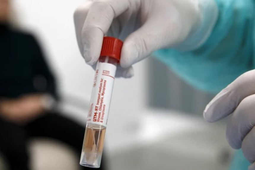 U regionu raste broj zaraženih, prva žrtva u Sloveniji