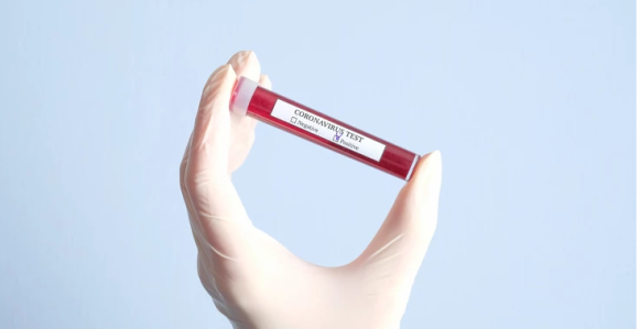 Kineski ekspert predviđa kraj epidemije virusa